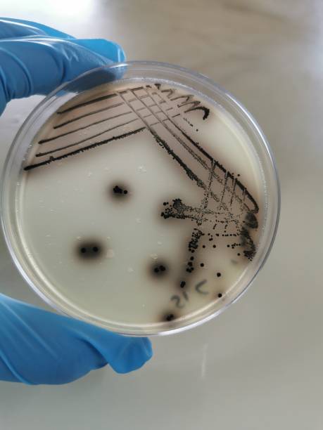 Bacteria Species Growing on a Baird-Parker Agar Plate Quadrant streak of a bacteria species growing on a Baird-Parker agar plate. staphylococcal enterotoxicosis stock pictures, royalty-free photos & images