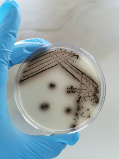 Bacteria Species Growing on a Baird-Parker Agar Plate Quadrant streak of a bacteria species growing on a Baird-Parker agar plate. staphylococcal enterotoxicosis stock pictures, royalty-free photos & images