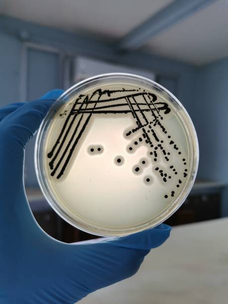 Staphylococcus aureus on Baird-Parker Agar A quadrant streak of the bacterium Staphylococcus aureus cultured or inoculated on Baird-Parker agar with egg tellurite . staphylococcal enterotoxicosis stock pictures, royalty-free photos & images