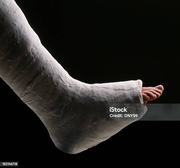 Broken Leg Stock Photo - Download Image Now - Orthopedic Cast, Broken Leg, Ankle