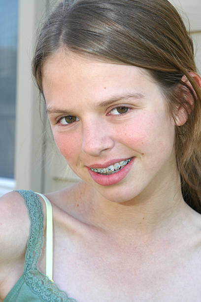 istock Teen with Braces 182161022