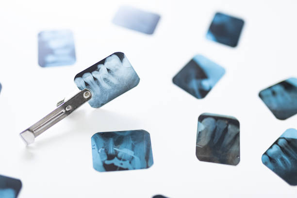 Group of dental x-ray being stock photo