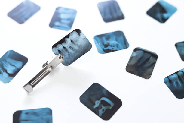 istock Group of dental x-ray being 1821619345