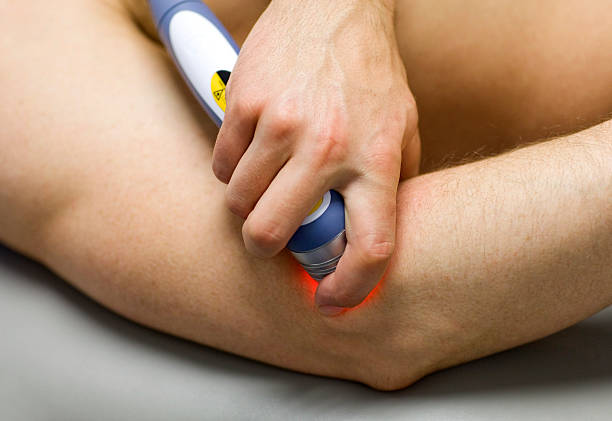 Laser Physical Therapy Sports medicine practitioner administering cold laser therapy to a patient. light therapy stock pictures, royalty-free photos & images