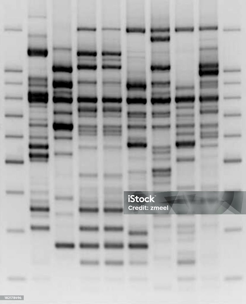 Comparative DNA analysis Gel electrophoresis of DNA fragments. The gel was photographed and retouched in PS. DNA Stock Photo