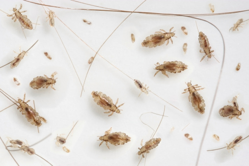 Head Louse InfestationHead lice at various stages of development from egg to imago ( adult ) on white backgroundPlease see some similar images from my portfolio :