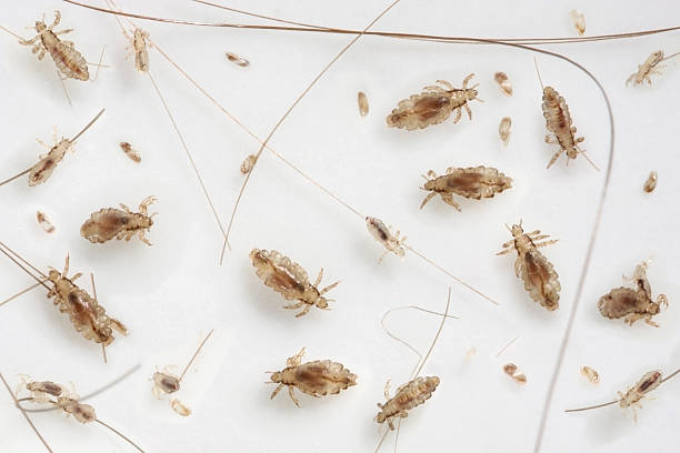 Head Louse Infestation Head Louse InfestationHead lice at various stages of development from egg to imago ( adult ) on white backgroundPlease see some similar images from my portfolio : parasite infestation stock pictures, royalty-free photos & images