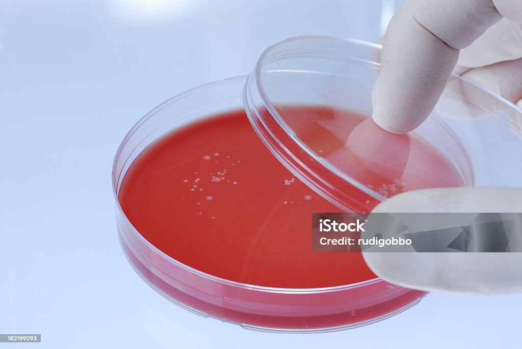 Piastra Petri - Foto stock royalty-free di Agar sangue