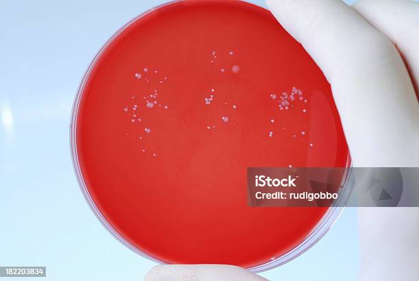 Batteri - Fotografie stock e altre immagini di Agar - Agar, Agar sangue, Attrezzatura