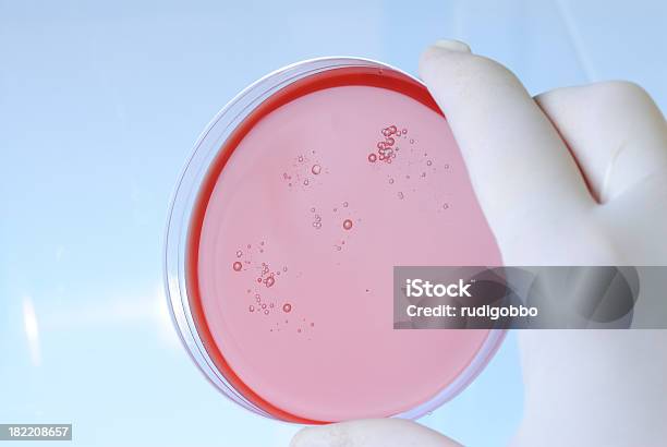 血液寒天培地プレートバクテリア - シャーレのストックフォトや画像を多数ご用意 - シャーレ, バクテリア, ブドウ球菌