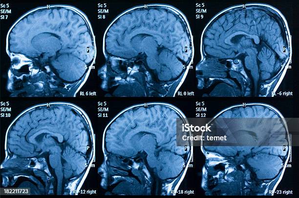 뇌 Mri 스캔 뇌에 대한 스톡 사진 및 기타 이미지 - 뇌, MRI 스캔, 의료용 스캔
