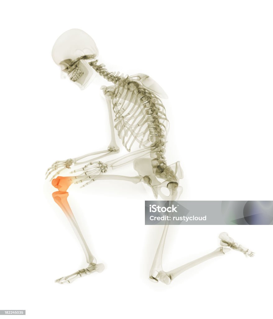 Dolor de la rodilla humana - Foto de stock de Anatomía libre de derechos