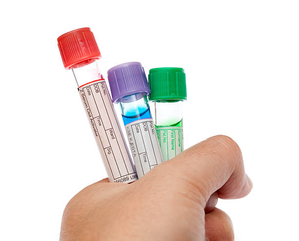 istock man holds several medical test tubes 182246444