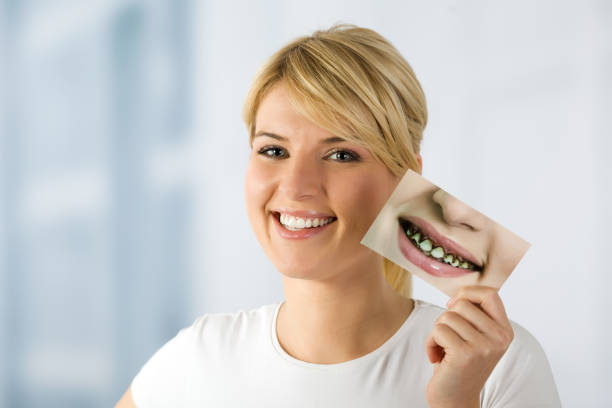 woman with image of rotten teeths Photo that model holding I made specially for this shooting.I am the author and copyright holder of the photo.In this photo is part of the same persons (model) who hold this photo. bad teeth stock pictures, royalty-free photos & images