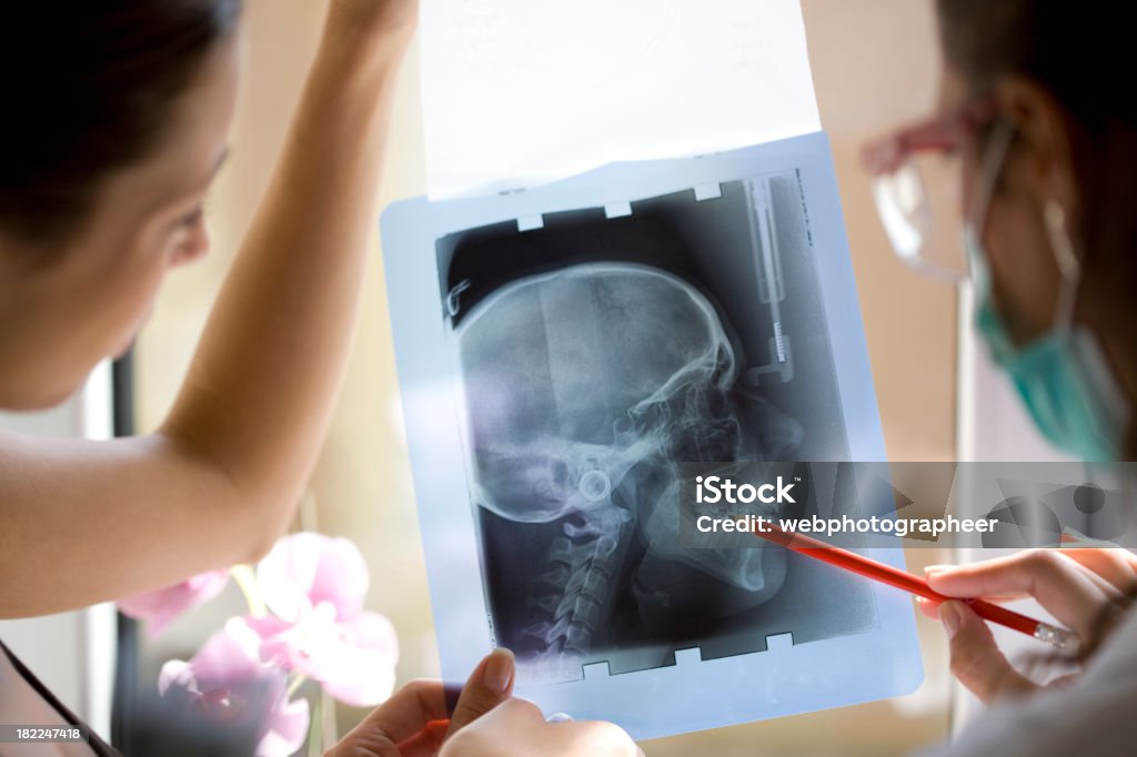 x-ray dentaire - Photo de Adulte libre de droits