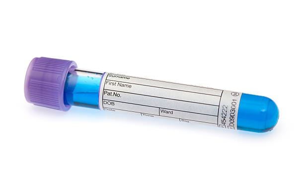 istock Test tube full of blue liquid 182248469