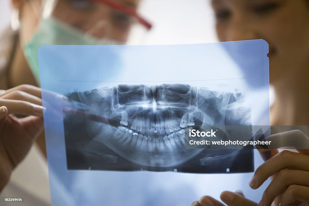 Dental x-ray - Lizenzfrei Unscharf gestellt Stock-Foto