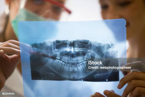 Dental Xray Stockfoto und mehr Bilder von Unscharf gestellt - Unscharf gestellt, Zahnarztpraxis, Analysieren