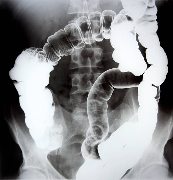 Gastroenterology This is an old method to  see intestinum.. gastroenterology photos stock pictures, royalty-free photos & images