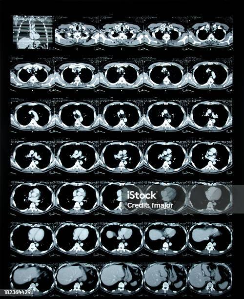 Seção - zdjęcia stockowe i więcej obrazów Brzuch - Brzuch, Tomografia komputerowa, Tomograf komputerowy