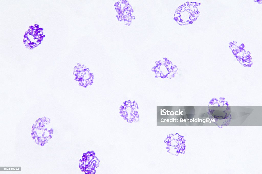 Salivary Gland Chromosomes Drosphila "Microscopic photo of a professionally prepared slide demonstrating the cellular structure of the object.NOTE: Shallow DOF, uneven focus and chromatic aberration are inherent in microscopy, and what appears as dust is actually in the sample.See all my" Abstract Stock Photo