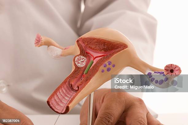 Intrauterine Gerät Stockfoto und mehr Bilder von Scheide - Scheide, Frauen, Verhütungsmittel