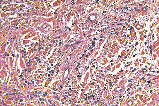 istock Mammary Gland Mast Cell Tumour 182412590