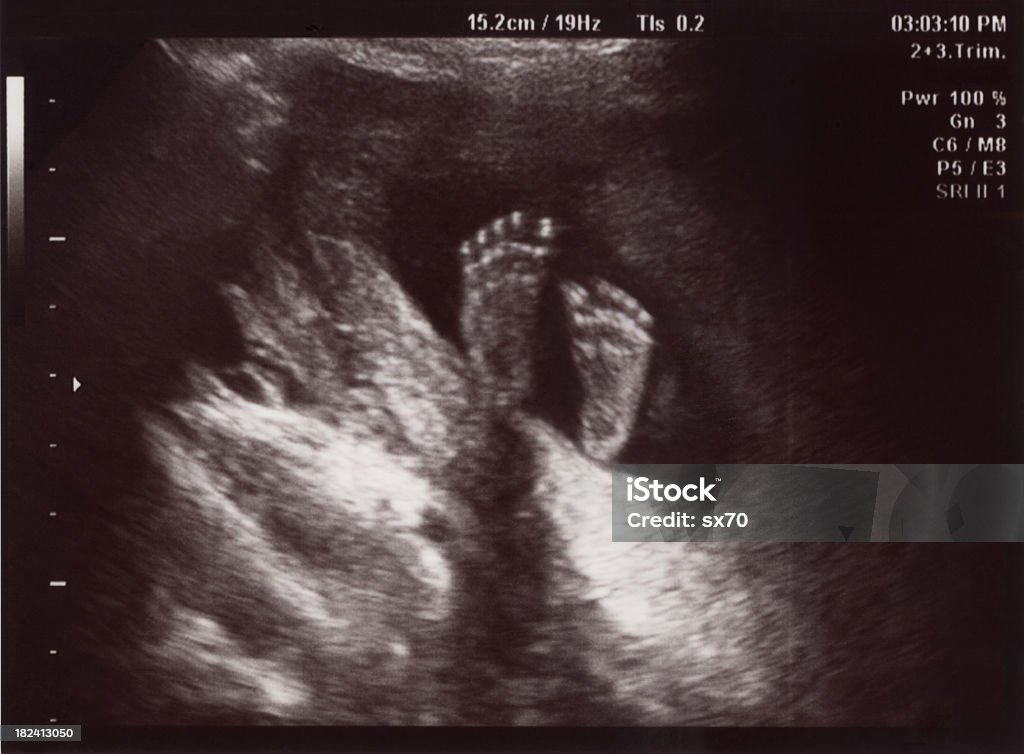 Little Big Feet in Uterus at 18 Weeks Ultrasound at 18 weeks Ultrasound Stock Photo