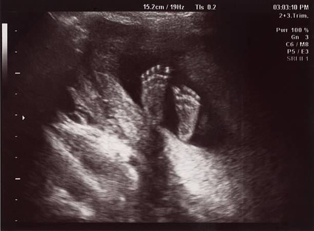 Little Big Feet in Uterus at 18 Weeks Ultrasound at 18 weeks fetus stock pictures, royalty-free photos & images