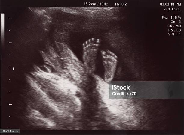 Little Big Feet In Uterus At 18 Weeks Stock Photo - Download Image Now - Ultrasound, Fetus, Uterus