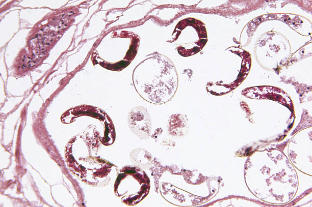 istock Fasciola Hepatica Liver Fluke Reproductive Regions TS 182414676