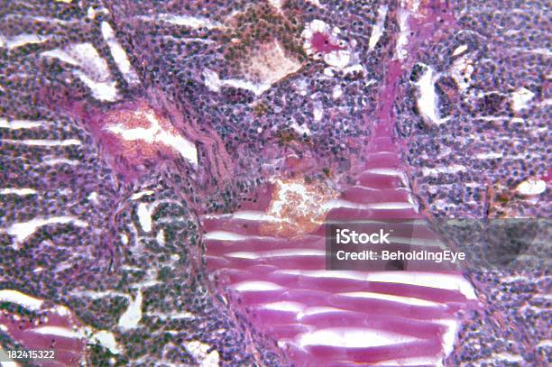 大きな甲状腺 Adenomatous 性過形成 - 甲状腺癌のストックフォトや画像を多数ご用意 - 甲状腺癌, 細胞, DNA