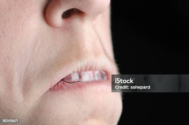 Beißen Dental Auf Vorschussbasis Stockfoto und mehr Bilder von Zahnschiene - Zahnschiene, Auf die Lippe beißen, Beißen
