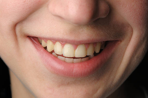 istock Smiling young person laughing 182417323