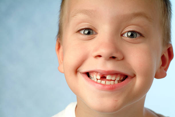 missing tooth funny image of young boy with missing tooth. gap toothed photos stock pictures, royalty-free photos & images