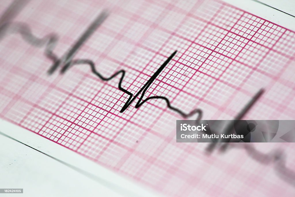 Battito del cuore - Foto stock royalty-free di Elettrocardiogramma