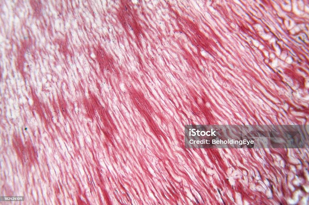 Rene iniezione vascolare - Foto stock royalty-free di Anatomia umana