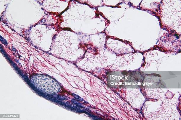 Płuc Vascular Wstrzyknięcia - zdjęcia stockowe i więcej obrazów Tkanka płucna - Tkanka płucna, Abstrakcja, Fotomikroskopia