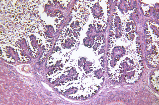 Microscopic image of ciliated epithelium