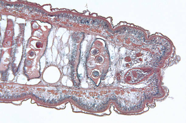 istock Tapeworm Cestoda Gravid Proglottid TS 182442090