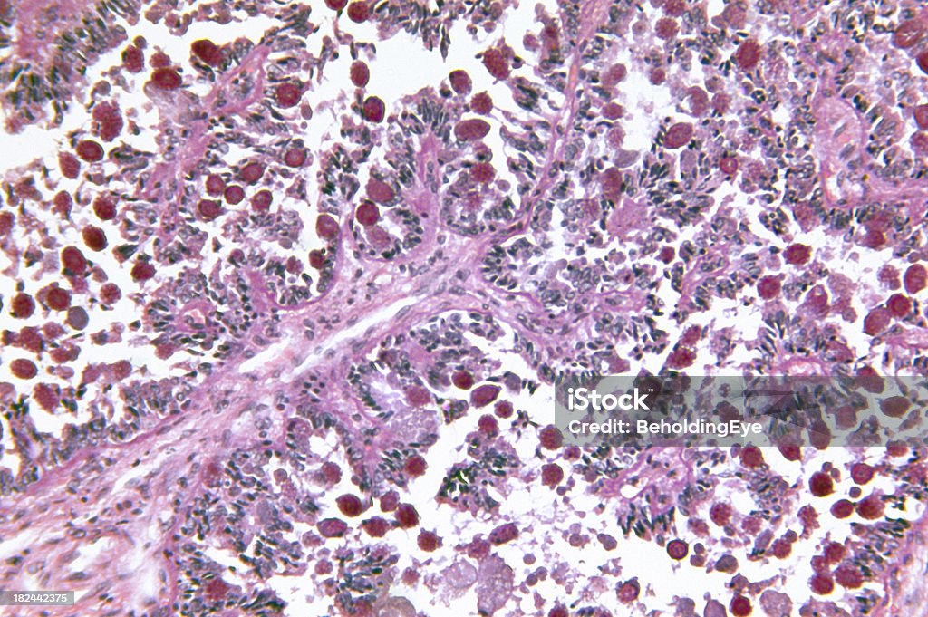 Coccidiosis の肝臓 - DNAのロイヤリティフリーストックフォト