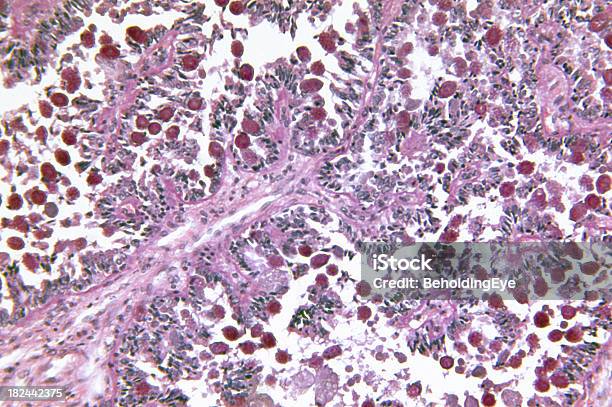 Coccidiosis の肝臓 - DNAのストックフォトや画像を多数ご用意 - DNA, クローズアップ, グランジ加工
