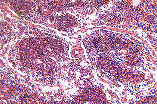 istock Close up of cells in a lymph node 182442655