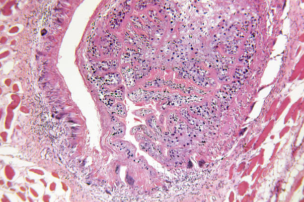 istock Cysticercus Parasite Encysted in Pig Muscle 182443189