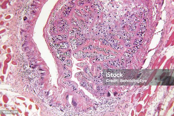 Cysticercus Parasite Encysted In Pig Muscle Stock Photo - Download Image Now - Abstract, Anatomy, Animal