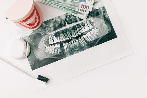 Jaw Model with Dental Panoramic X-ray and Money on White Background, Flat Lay. Orthodontic treatment.
