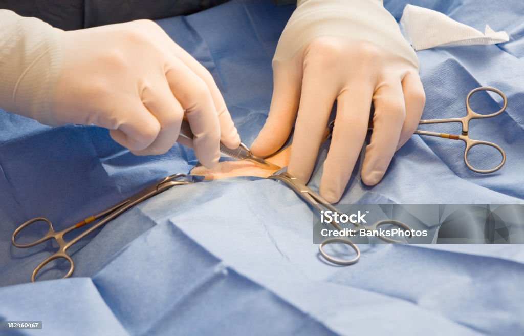 �군의관 제조 복용분 절개 한후 절개면을 함께 - 로열티 프리 메스-수술 장비 스톡 사진