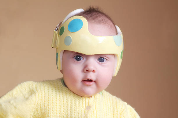 Cranial Orthodic for Plagiocephaly Infant wearing a helmet or band for treatment of plagiocephaly (misshapen head). (Helmet design painted/created by me). SEE ALSO: plagiocephaly stock pictures, royalty-free photos & images
