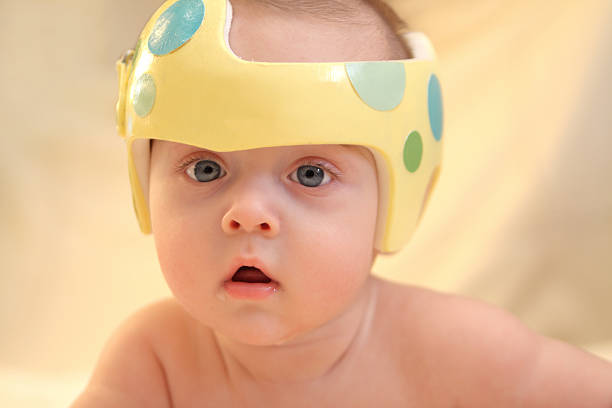 Cranial Orthodic for Plagiocephaly Infant wearing a helmet or band for treatment of plagiocephaly. Helmet design painted/created by me. Shallow Depth of Field.  SEE ALSO: plagiocephaly stock pictures, royalty-free photos & images