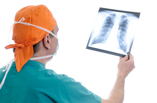 istock Doctor examining chest x-ray 182466150